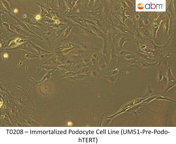 Immortalized Podocyte Progenitor Cell Line (UM51-Pre-Podo-hTERT) | Applied Biological Materials (abm)