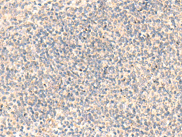 ADAMTS2 Polyclonal Antibody – Figure 1 of 2