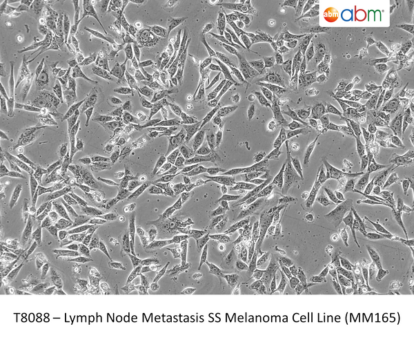 Lymph Node Metastasis SS Melanoma Cell Line (MM165) | Applied Biological Materials (abm)
