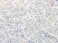 TIMM8A Polyclonal Antibody – Figure 1 of 2
