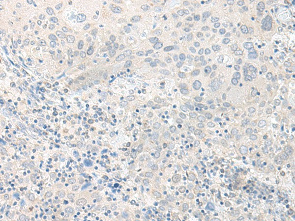 TIMM8A Polyclonal Antibody – Figure 1 of 2