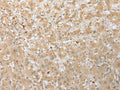 FNDC3B Polyclonal Antibody – Figure 1 of 3
