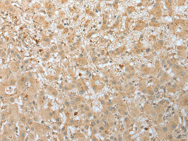 FNDC3B Polyclonal Antibody – Figure 1 of 3