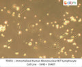 Immortalized Human Mononuclear B/T Lymphocyte Cell Line  - SV40 + SV40T | Applied Biological Materials (abm)