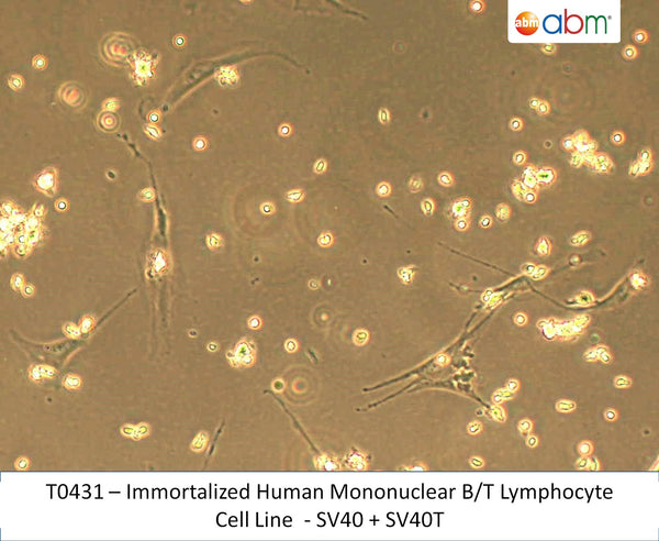 Immortalized Human Mononuclear B/T Lymphocyte Cell Line  - SV40 + SV40T | Applied Biological Materials (abm)