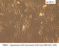Squamous Cell Carcinoma Cell Line (UM-SCC-129) | Applied Biological Materials (abm)