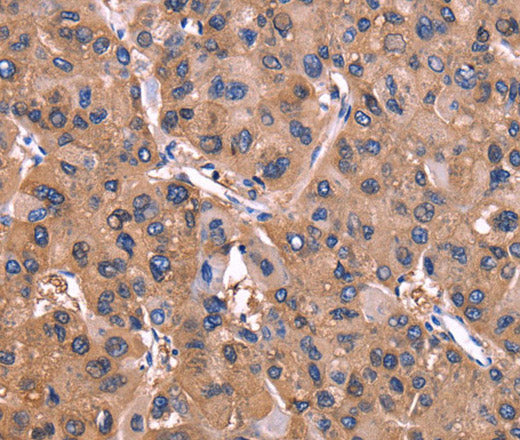 ADM2 Polyclonal Antibody – Figure 1 of 3