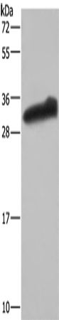 GSTA3 Polyclonal Antibody – Figure 1 of 4