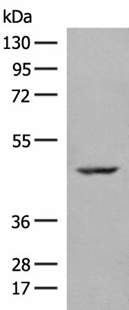 ZBTB8A Polyclonal Antibody – Figure 1 of 4