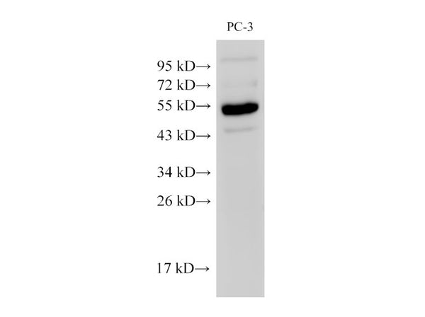 Chromogranin A Polyclonal Antibody – Figure 1 of 5