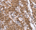 ID4 Polyclonal Antibody – Figure 1 of 3