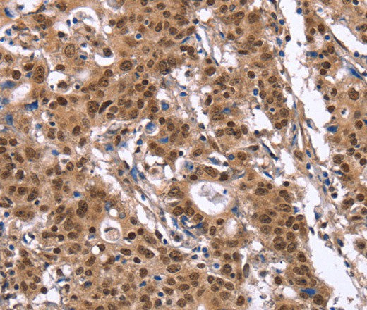 ID4 Polyclonal Antibody – Figure 1 of 3