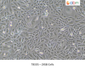2XSB Cells – Figure 1 of 1