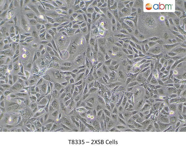 2XSB Cells – Figure 1 of 1
