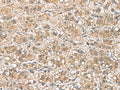 PHLDA3 Polyclonal Antibody – Figure 1 of 2