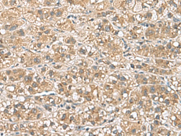 PHLDA3 Polyclonal Antibody – Figure 1 of 2