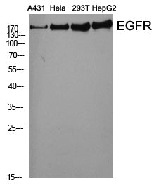 EGFR Polyclonal Antibody – Figure 1 of 4