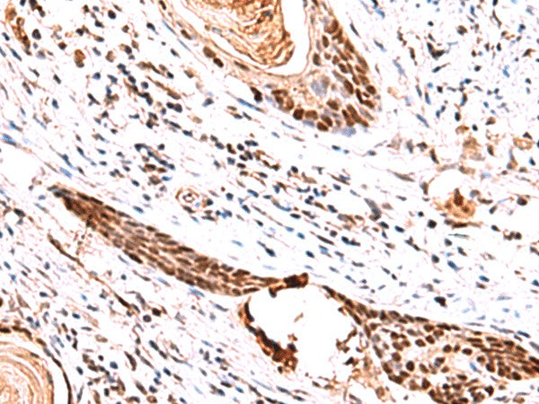IRF2BP1 Polyclonal Antibody – Figure 1 of 3