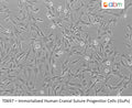 Immortalized Human Cranial Suture Progenitor Cells (iSuPs) | Applied Biological Materials (abm)