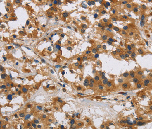 IL17RB Polyclonal Antibody – Figure 1 of 4