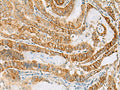 FARP2 Polyclonal Antibody – Figure 1 of 3