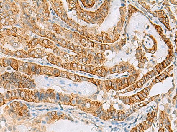 FARP2 Polyclonal Antibody – Figure 1 of 3