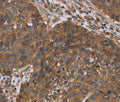 OXTR Polyclonal Antibody – Figure 1 of 2