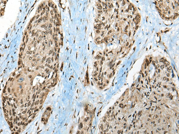 CCDC12 Polyclonal Antibody – Figure 1 of 3