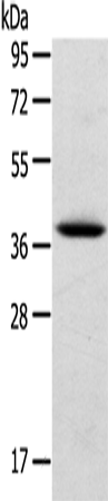 TPM2 Polyclonal Antibody – Figure 1 of 4