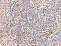 GRIA2 Polyclonal Antibody – Figure 1 of 2