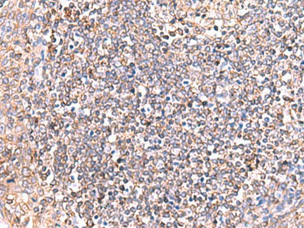 GRIA2 Polyclonal Antibody – Figure 1 of 2