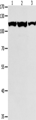 MCM3 Polyclonal Antibody – Figure 1 of 4