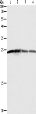 BAK1 Polyclonal Antibody – Figure 1 of 2
