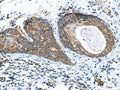 AP1S3 Polyclonal Antibody – Figure 1 of 3