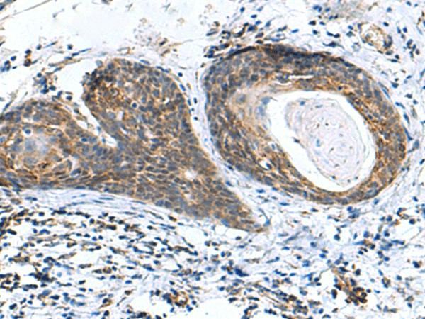 AP1S3 Polyclonal Antibody – Figure 1 of 3