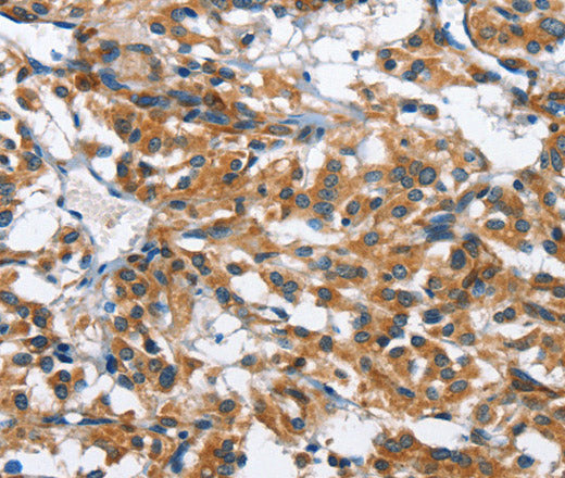 BPI Polyclonal Antibody – Figure 1 of 3