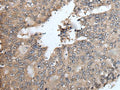 TRIM23 Polyclonal Antibody – Figure 1 of 3