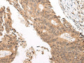 CHAMP1 Polyclonal Antibody – Figure 1 of 3