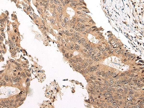 CHAMP1 Polyclonal Antibody – Figure 1 of 3