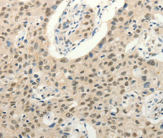 Frizzled 10 Polyclonal Antibody – Figure 1 of 3
