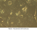 Panc20 (CCJ-41T) Cell Line | Applied Biological Materials (abm)