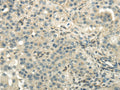 DLAT Polyclonal Antibody – Figure 1 of 3