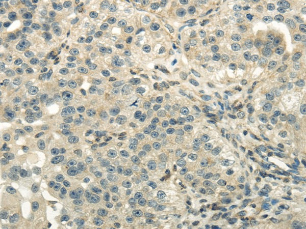 DLAT Polyclonal Antibody – Figure 1 of 3