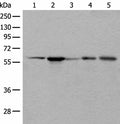 BAIAP2L1 Polyclonal Antibody – Figure 1 of 4