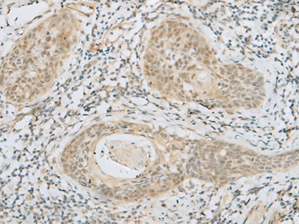 HELT Polyclonal Antibody – Figure 1 of 3