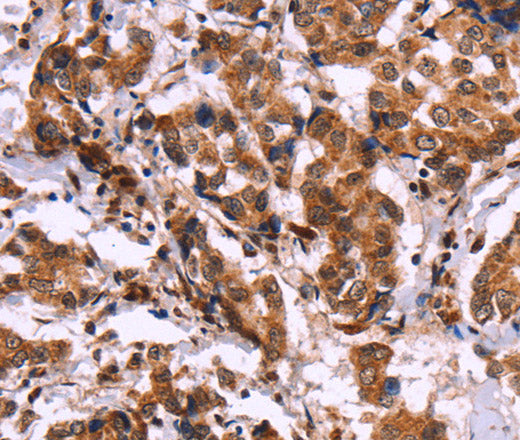 CARD11 Polyclonal Antibody – Figure 1 of 3