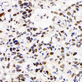 HDAC2 Polyclonal Antibody – Figure 1 of 4