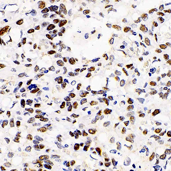 HDAC2 Polyclonal Antibody – Figure 1 of 4