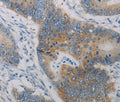 CD303 Polyclonal Antibody – Figure 1 of 3