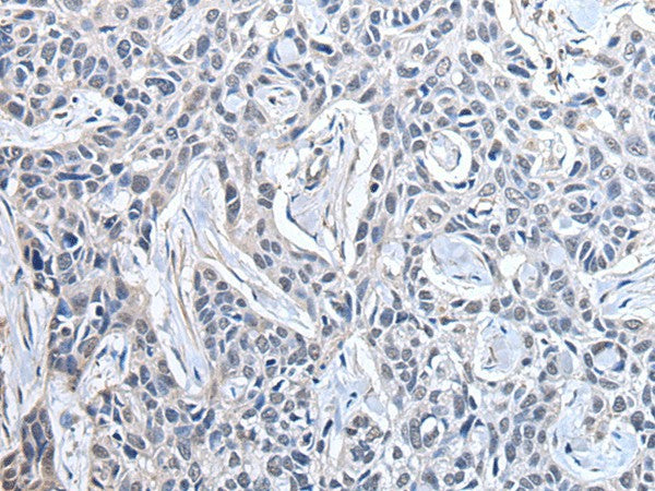 PPIG Polyclonal Antibody – Figure 1 of 2